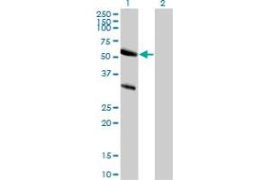 Western Blot analysis of TRAF7 expression in transfected 293T cell line by TRAF7 polyclonal antibody. (TRAF7 抗体  (AA 334-356))
