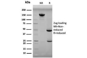 SDS-PAGE Analysis Purified Progesterone Mouse Monoclonal Antibody (6-5E-3F). (Progesterone 抗体)