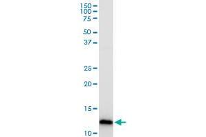 Western Blotting (WB) image for anti-Cytochrome C Oxidase Subunit Vb (COX5B) (AA 1-129) antibody (ABIN514530)