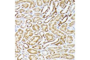 Immunohistochemistry (IHC) image for anti-Bone Morphogenetic Protein Receptor, Type IB (BMPR1B) (AA 1-126) antibody (ABIN3022720)