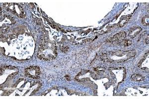 IHC analysis of MCM6 using anti-MCM6 antibody (ABIN7600036). (MCM6 抗体  (AA 14-821))