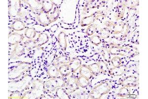 Formalin-fixed and paraffin embedded mouse kidney tissue labeled with Anti-Cathepsin H Polyclonal Antibody, Unconjugated  at 1:200 followed by conjugation to the secondary antibody, (SP-0023), and DAB staining (Cathepsin H 抗体  (AA 71-170))