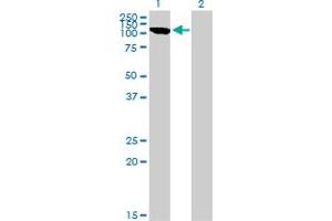Western Blot analysis of CLCN2 expression in transfected 293T cell line by CLCN2 monoclonal antibody (M01), clone 3E1. (CLCN2 抗体  (AA 38-387))