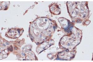 Immunohistochemistry of paraffin-embedded Human placenta using RPS13 Polyclonal Antibody at dilution of 1:100 (40x lens). (RPS13 抗体)