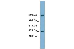 LGALS14 antibody used at 1 ug/ml to detect target protein. (LGALS14 抗体  (N-Term))