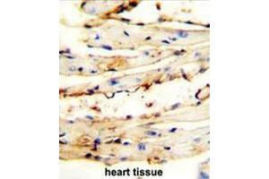 CRCT1 antibody (N-term) immunohistochemistry analysis in formalin fixed and paraffin embedded mouse heart tissue followed by peroxidase conjugation of the secondary antibody and DAB staining. (CRCT1 抗体  (N-Term))