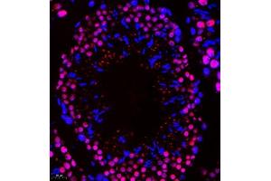 Immunofluorescence of paraffin embedded mouse testis using Api5 (ABIN7073094) at dilution of 1:400 (400x lens) (Apoptosis Inhibitor 5 抗体)