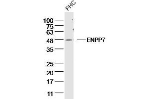FHC Cell lysates probed with ENPP7 Polyclonal Antibody, unconjugated  at 1:300 overnight at 4°C followed by a conjugated secondary antibody for 60 minutes at 37°C. (ENPP7 抗体  (AA 351-458))