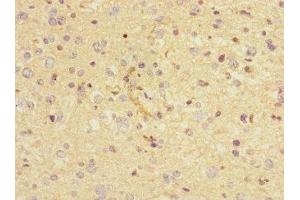 Immunohistochemistry of paraffin-embedded human glioma using ABIN7161350 at dilution of 1:100 (CHRNA9 抗体  (AA 26-240))