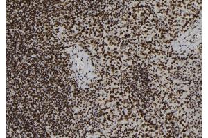 ABIN6277977 at 1/100 staining Mouse spleen tissue by IHC-P. (FYB 抗体)