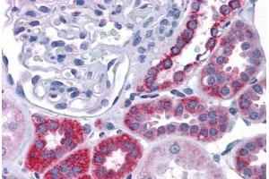 Human Kidney: Formalin-Fixed, Paraffin-Embedded (FFPE) (IDH2 抗体  (AA 354-452))