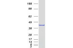 Western Blotting (WB) image for Enoyl-CoA Delta Isomerase 2 (PECI) (Transcript Variant 1) protein (Myc-DYKDDDDK Tag) (ABIN2728629)