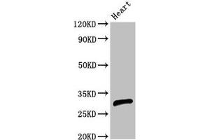 Western Blot Positive WB detected in: Rat heart tissue All lanes: CEBPE antibody at 2. (CEBPE 抗体  (AA 1-200))
