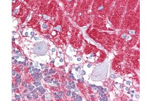 Immunohistochemistry (IHC) image for anti-Guanine Nucleotide Binding Protein (G Protein), alpha Activating Activity Polypeptide O (GNAO1) (AA 108-157) antibody (ABIN6748528)