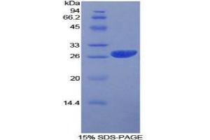 SDS-PAGE analysis of Human Prion Protein. (PRNP 蛋白)