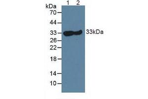Western blot analysis of (1) Mouse Skeletal Muscle Tissue and (2) Rat Skeletal Muscle Tissue. (CA3 抗体  (AA 2-260))