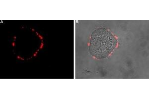 Expression of SSTR5 in human HT-29 cells - Cell surface detection of SSTR5 in intact living human colorectal adenocarcinoma (HT-29) cells. (SSTR5 抗体  (Extracellular, N-Term))