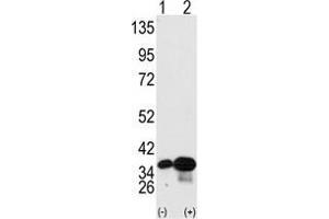 Western blot analysis of PHB2 (arrow) using PHB2 Antibody . (Prohibitin 2 抗体  (Tyr248))