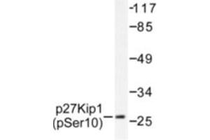 Image no. 1 for anti-Cyclin-Dependent Kinase Inhibitor 1B (p27, Kip1) (CDKN1B) (pSer10) antibody (ABIN318090) (CDKN1B 抗体  (pSer10))