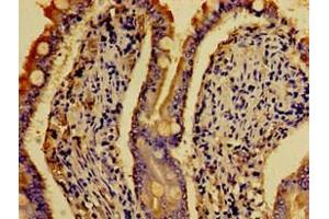 Immunohistochemistry of paraffin-embedded human small intestine tissue using ABIN7142640 at dilution of 1:100 (Serotonin Receptor 4 抗体  (AA 316-388))