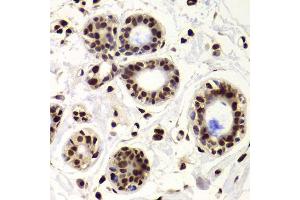 Immunohistochemistry of paraffin-embedded human breast using XRCC6 Antibody.