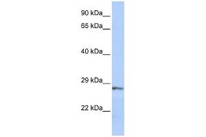 SFRP2 antibody used at 1 ug/ml to detect target protein. (SFRP2 抗体  (Middle Region))