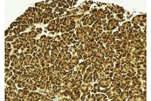 ABIN6279525 at 1/100 staining Mouse pancreas tissue by IHC-P. (MED15 抗体  (C-Term))