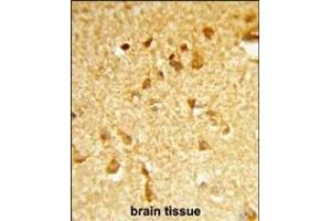 Formalin-fixed and paraffin-embedded human brain tissue reacted with DDX17 Antibody (N-term), which was peroxidase-conjugated to the secondary antibody, followed by DAB staining. (DDX17 抗体  (N-Term))