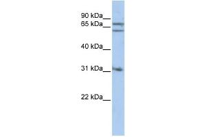 WB Suggested Anti-GPHN Antibody Titration: 0. (Gephyrin 抗体  (Middle Region))