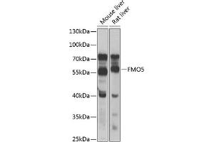 Western blot analysis of extracts of various cell lines, using FMO5 antibody (ABIN6133516, ABIN6140714, ABIN6140715 and ABIN6223596) at 1:1000 dilution. (FMO5 抗体  (AA 1-285))