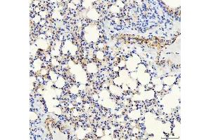 anti-Cadherin 5 (CDH5) (AA 46-285) antibody