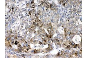 Immunohistochemistry (IHC) image for anti-Cytochrome P450, Family 2, Subfamily D, Polypeptide 6 (CYP2D6) (AA 315-347) antibody (ABIN5647528)
