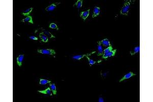 IF analysis of TRIM6 using anti-TRIM6 antibody (ABIN7601905).