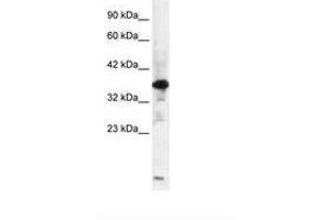 Image no. 2 for anti-Zinc Finger Protein-Like 1 (ZFPL1) (AA 101-150) antibody (ABIN6735842) (ZFPL1 抗体  (AA 101-150))