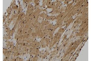 ABIN6273130 at 1/100 staining Mouse heart tissue by IHC-P. (KIF18A 抗体  (Internal Region))