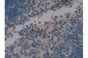IHC-P analysis of Mouse Spleen Tissue, with DAB staining. (Ki-67 抗体  (AA 2386-2674))