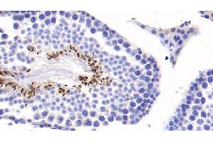 Detection of COMP in Mouse Testis Tissue using Monoclonal Antibody to Cartilage Oligomeric Matrix Protein (COMP) (COMP 抗体  (AA 554-753))
