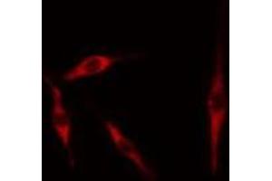 ABIN6276729 staining 293 cells by IF/ICC. (Tryptophan Hydroxylase 1 抗体  (Internal Region))
