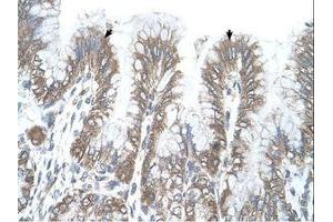 Image no. 1 for anti-arginine/serine-Rich Coiled-Coil 2 (RSRC2) (AA 363-412) antibody (ABIN321837) (RSRC2 抗体  (AA 363-412))
