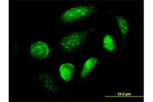 Immunofluorescence of monoclonal antibody to GCM1 on HeLa cell. (GCM1 抗体  (AA 108-166))