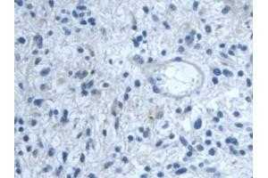 Immunohistochemistry (IHC) image for anti-Transforming Growth Factor, beta-Induced, 68kDa (TGFBI) (AA 423-632) antibody (ABIN7431149)