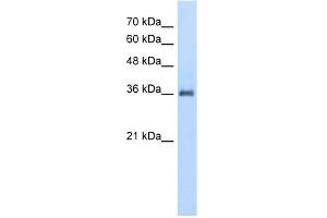 WB Suggested Anti-PPAP2A Antibody Titration:  5. (PPAP2A 抗体  (N-Term))