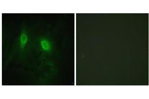 Immunofluorescence analysis of HeLa cells, using IKK- gamma (epitope around residue 85) antibody.
