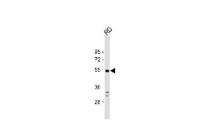 Anti-DUSP10 Antibody (N-term) at 1:1000 dilution + RD whole cell lysate Lysates/proteins at 20 μg per lane. (DUSP10 抗体  (N-Term))