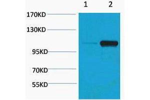 Western Blotting (WB) image for anti-Pepsinogen C (PGC) (pSer15) antibody (ABIN3178873) (PGC 抗体  (pSer15))