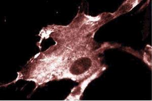 Immunofluorescence staining of WI-38 cells (Human lung fibroblasts, ATCC CCL-75). (IQGAP1 抗体  (AA 1348-1490))