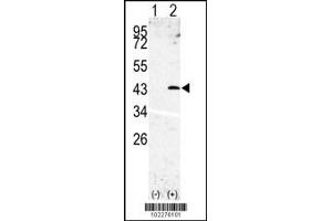 Western blot analysis of SPPL3 using rabbit polyclonal SPPL3 Antibody using 293 cell lysates (2 ug/lane) either nontransfected (Lane 1) or transiently transfected with the SPPL3 gene (Lane 2). (SPPL3 抗体  (N-Term))