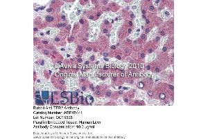 Immunohistochemistry (IHC) image for anti-Transferrin Receptor 2 (TFR2) (N-Term) antibody (ABIN2782221) (Transferrin Receptor 2 抗体  (N-Term))