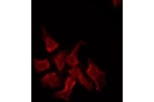 Immunofluorescence (fixed cells) (IF/ICC) image for anti-ATP-Binding Cassette, Sub-Family C (CFTR/MRP), Member 2 (ABCC2) (Internal Region) antibody (ABIN6257920)