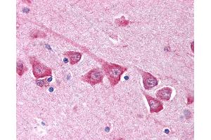 Immunohistochemistry (IHC) image for anti-Sodium Channel, Voltage-Gated, Type III, beta Subunit (SCN3B) (AA 65-114) antibody (ABIN214184)